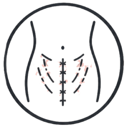 Icon Abdominal Surgery