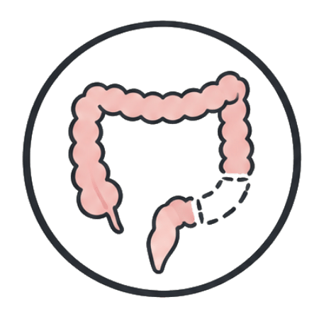 Icon Colectomy(1)