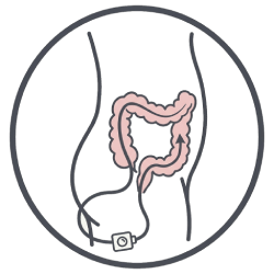 Icon Colonoscopy