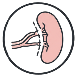 Icon Splenectomy Surgery